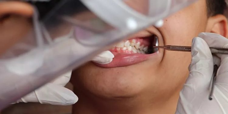 Pesquisa para avaliar as condições da saúde bucal da população passa por 3 cidades do Cariri