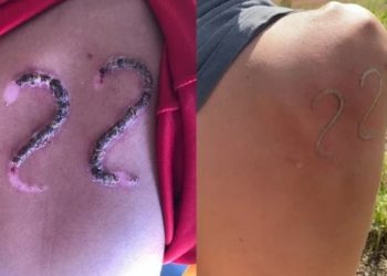 Adolescente de 17 anos marcou o número de Jair Bolsonaro com ferro em brasa (Foto: Reprodução)