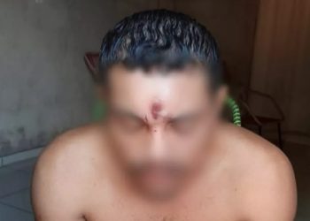 Homem levou tiro na testa e sobreviveu em Araguaína (TO) (Foto: Reprodução/Redes sociais)