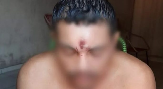 Homem leva tiro na testa, cai de moto e vai para casa dormir