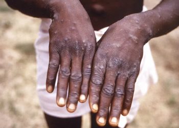 (Foto: CDC/Associated Press)