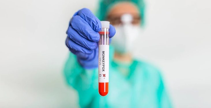 Varíola dos macacos não tem potencial de causar surtos no Ceará, afirma secretária executiva da Sesa