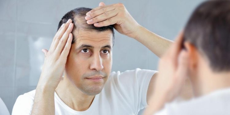 Medicamento diminui calvície em homens e trata problema na próstata