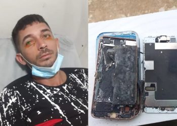 Agricultor pode perder olho direito após explosão de celular em Pedra Branca, no Ceará (Foto: Arquivo pessoal)