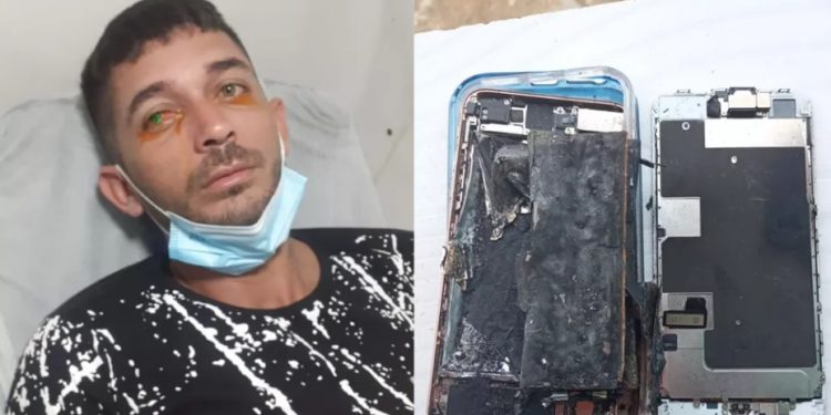Celular explode em rosto de agricultor no interior do Ceará