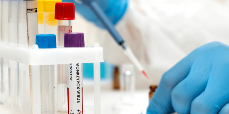 Varíola dos macacos: número de casos suspeitos aumenta 79% em 10 dias no CE