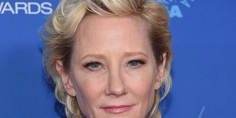 Anne Heche tem morte cerebral anunciada e aparelhos serão desligados