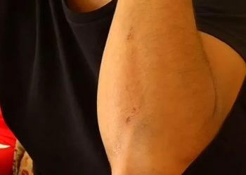 Vendedor denuncia agressões que teriam sido motivadas por racismo em saída de festa no Crato (Foto: Reprodução)