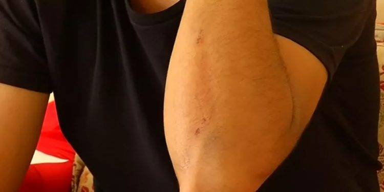 Crato: Vendedor agredido por segurança de festa diz que crime foi motivado por racismo