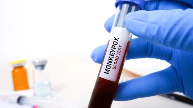 Varíola dos macacos: sobe para 14 número de casos confirmados da doença no Ceará