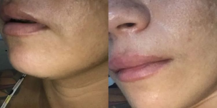 Cantora denuncia ex-namorado por agressão com soco na boca, no Interior do Ceará