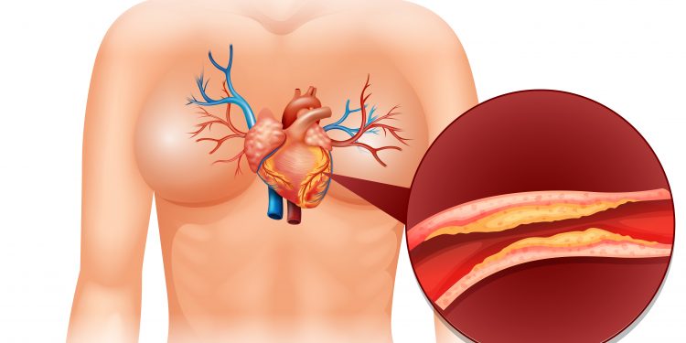Colesterol é essencial, mas em excesso traz riscos; veja o que eleva a taxa