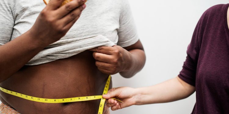 Doenças relacionadas à obesidade podem ser irreversíveis; entenda