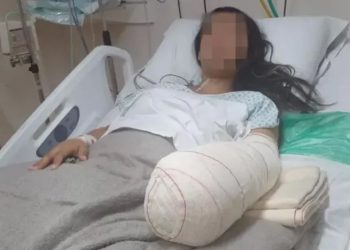 Gleice Kelly Gomes, de 24 anos, teve a mão e o punho esquerdos amputados, depois de dar à luz (Foto: Reprodução)