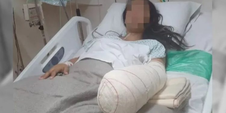 Mulher vai para hospital dar à luz e volta com mão e punho amputados