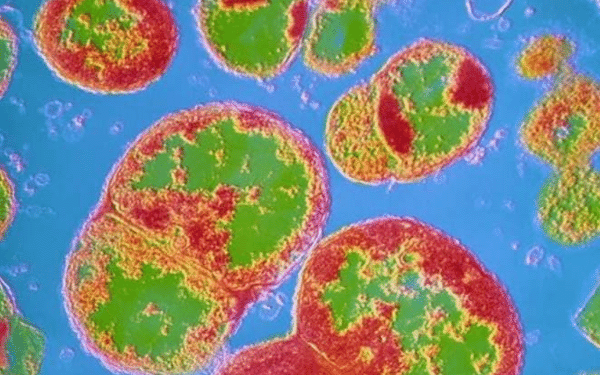 ‘Supergonorreia’: o que se sabe sobre a doença