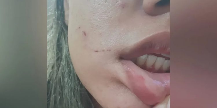 Segunda jovem afirma ter sido agredida por médico preso em Juazeiro do Norte: ‘Disse que iria me matar’