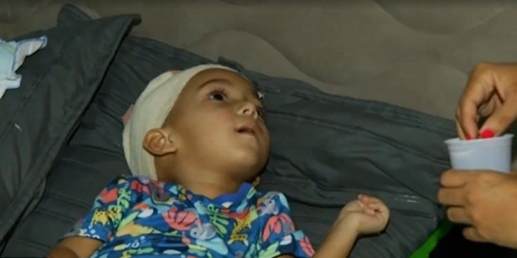 Criança picada por escorpião em Barbalha não consegue andar nem falar