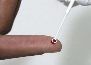 Realização de teste rápido de HIV, desenvolvido pelo Instituto de Tecnologia em Imunobiológicos (Bio-manguinhos) (Foto: Vinicius Marinho/Fiocruz)