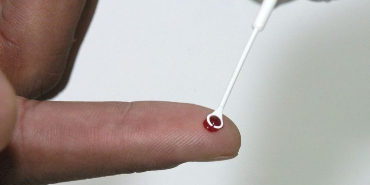 PrEP: tratamento preventivo é alternativa no combate ao HIV no Brasil