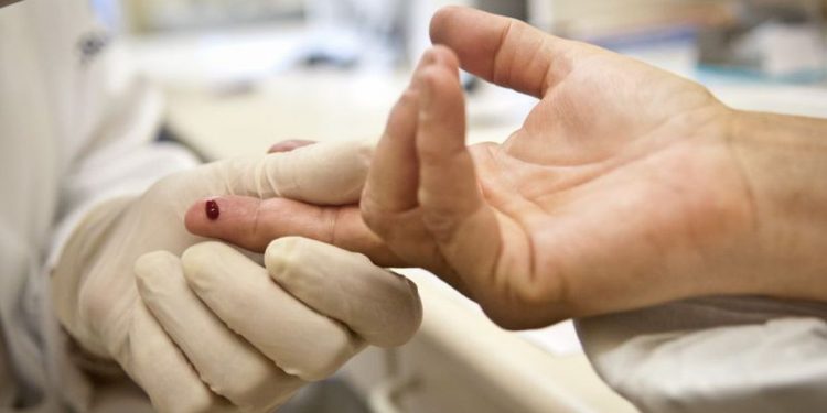 Pandemia de Aids pode acabar até 2030, diz Unaids