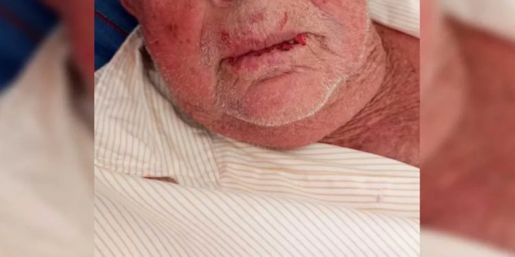 Criminosos invadem casa em Várzea Alegre, agridem idoso e roubam R$ 100 mil