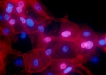 Cultura de células de câncer de mama vistas em microscópio eletrônico (Foto: Ewa Krawczyk, National Cancer Institute/Georgetown Lombardi Comprehensive Cancer Center)