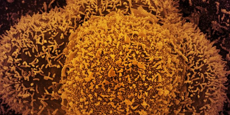 Nova subvariante da Covid-19 é identificada em Mato Grosso