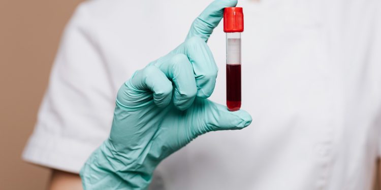 Junho Vermelho: Hemoce realiza campanha de incentivo à doação voluntária de sangue