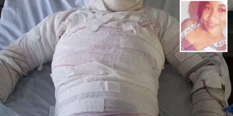 Homem ateia fogo e queima corpo de ex-mulher no interior do Ceará; filha da vítima também sofreu queimaduras