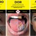 Anvisa discute novas imagens de advertência em embalagens de cigarro