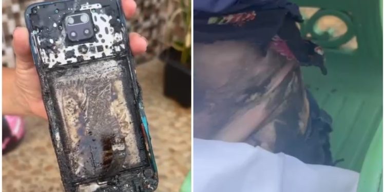 Celular pega fogo e causa queimaduras graves em mulher no Crato