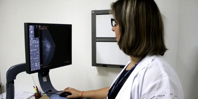 Entidades médicas defendem ampliação da mamografia de rastreamento e pressionam ANS