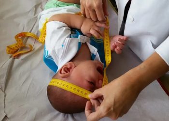 Crianças com deficiência causada pelo zika vírus terão indenização; veja valor e como solicitar