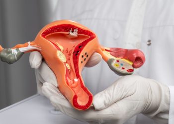 Segundo o Instituto Nacional do Câncer (Inca) o câncer de ovário é a terceira neoplasia ginecológica mais comum (Foto: Freepik)