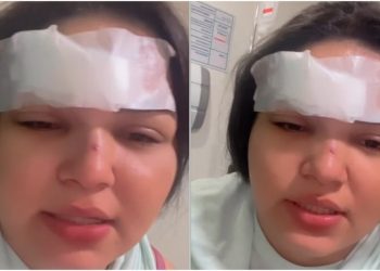 Gracielly foi agredida e teve testa cortada por golpe de gargalo de garrafa no Crato (Foto: Reprodução)