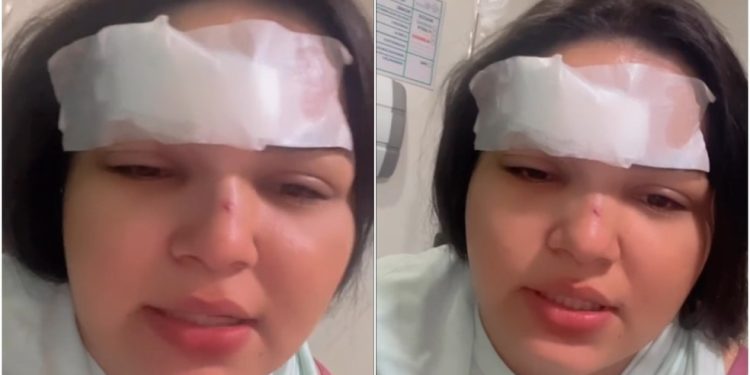Cantora é agredida por ciúmes no Crato, sofre corte na testa e vai parar no hospital