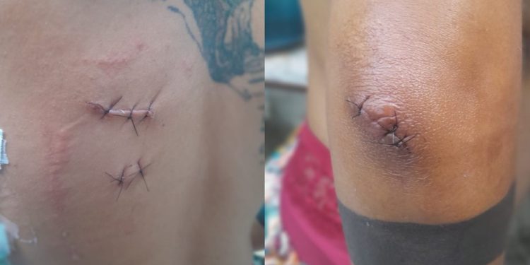 Homem é condenado a quase 30 anos de prisão por tentativa de feminicídio contra ex-companheira em Juazeiro do Norte