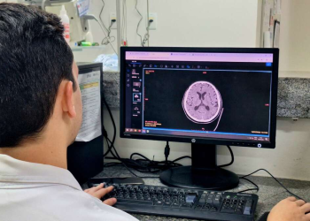 Saúde do cérebro: especialistas alertam sobre riscos, prevenção e cuidados essenciais