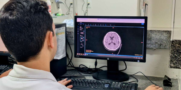 Saúde do cérebro: especialistas alertam sobre riscos, prevenção e cuidados essenciais