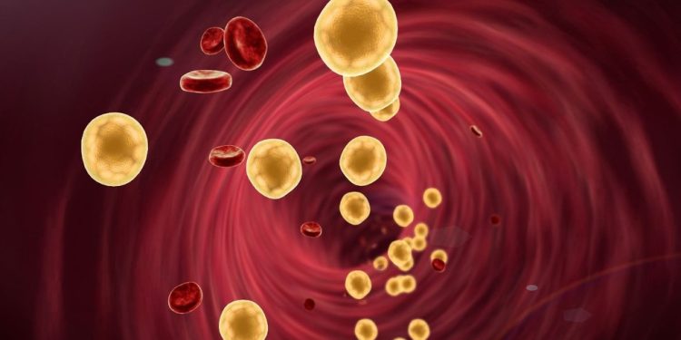 SBC endurece metas de colesterol e cria categoria de risco extremo para prevenção cardiovascular