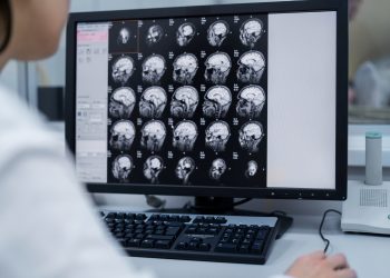 Segredo do envelhecimento cerebral pode reescrever terapias contra Alzheimer e Parkinson