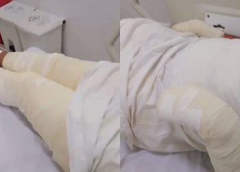 Homem é preso no Crato após atear fogo no próprio irmão enquanto ele dormia