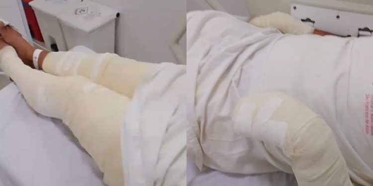 Homem é preso no Crato após atear fogo no próprio irmão enquanto ele dormia