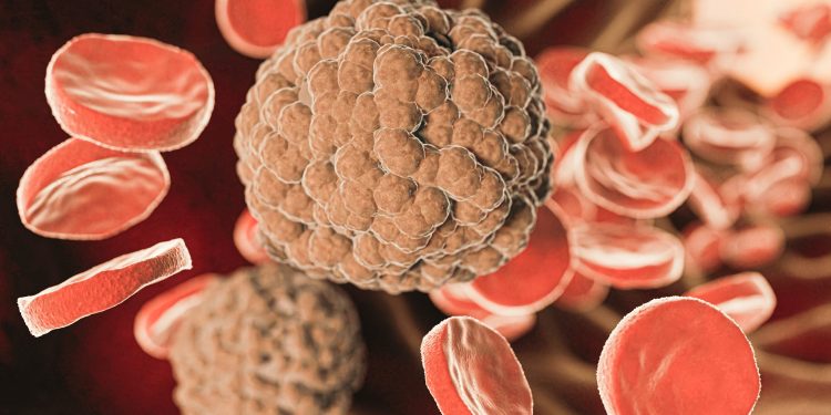 Brasil registra primeiro tratamento CAR-T totalmente produzido no país, com resultados robustos contra cânceres avançados