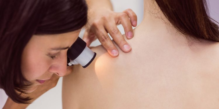 Câncer de pele registra alta expressiva no Brasil e revela desigualdades no acesso ao diagnóstico e tratamento